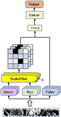 MAE-TransRNet: An improved transformer-ConvNet architecture with masked autoencoder for cardiac MRI registration